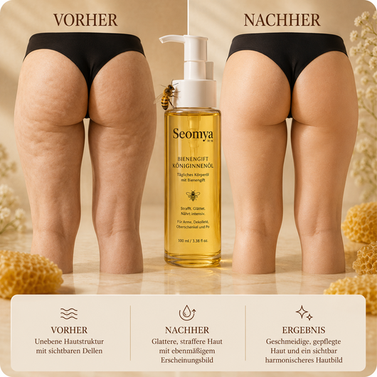 KÖNIGINNENÖL - Körperöl mit Bienengift